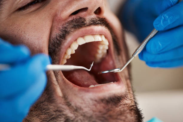 Best Emergency Care for Gum Disease in North Corbin, KY